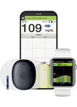 Eversense 365